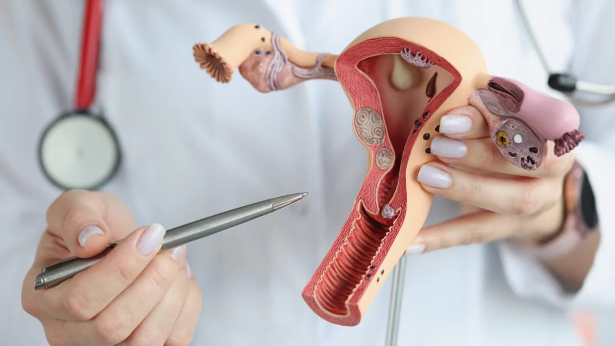 identifican-indicador-clave-que-anticipa-la-recaida-en-el-cancer-de-endometrio-mas-frecuente