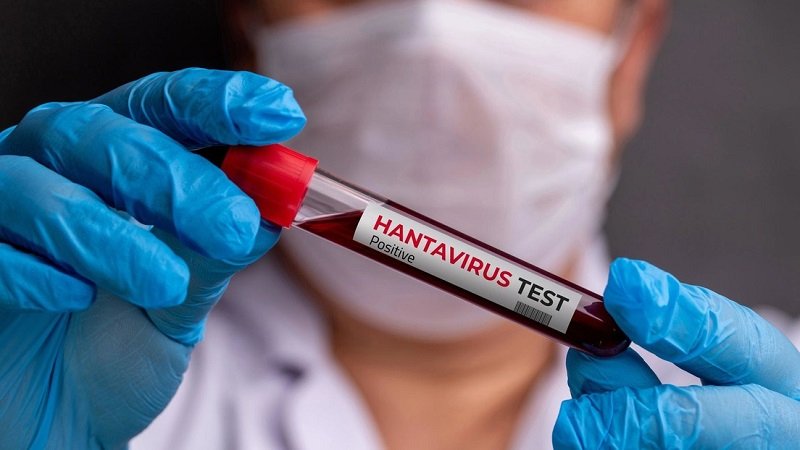 Identifican al ‘paciente cero’ de hantavirus y sus posibles causas de contagio