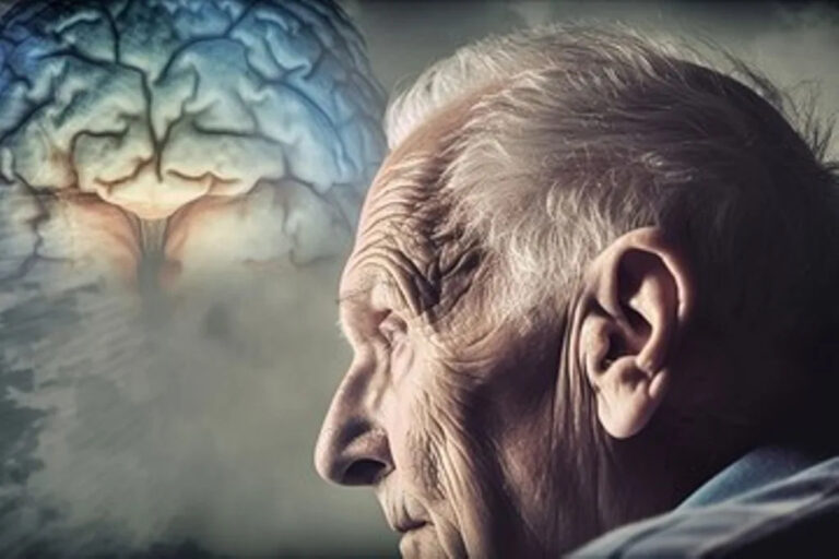 Cambios cerebrales vinculados al Alzheimer podrían comenzar desde los 50 años, revela estudio