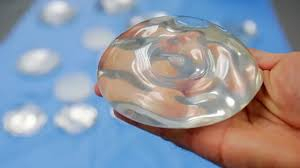España detecta 111 casos de un cáncer raro asociado a implantes mamarios