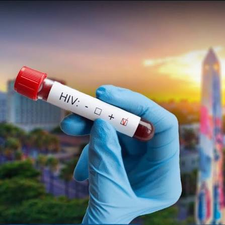 Informe revela distribución de pacientes extranjeros con VIH en el sistema de salud dominicano