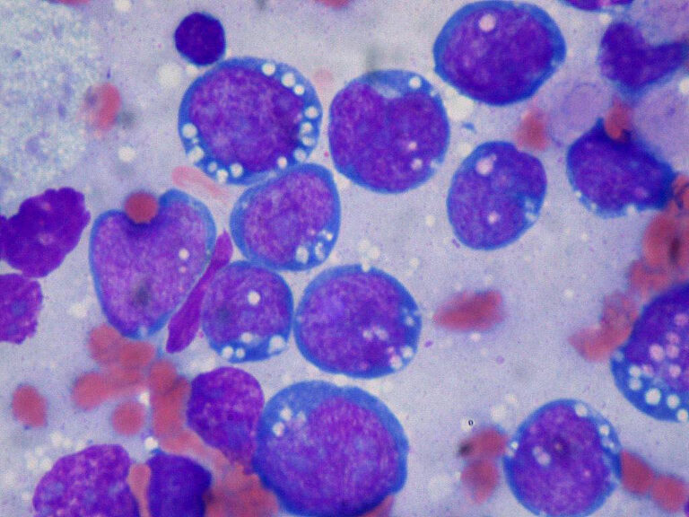 La ‘dieta anticáncer’ no existe, según los expertos