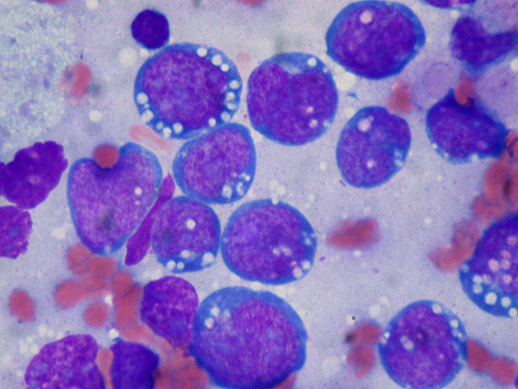 La ‘dieta anticáncer’ no existe, según los expertos